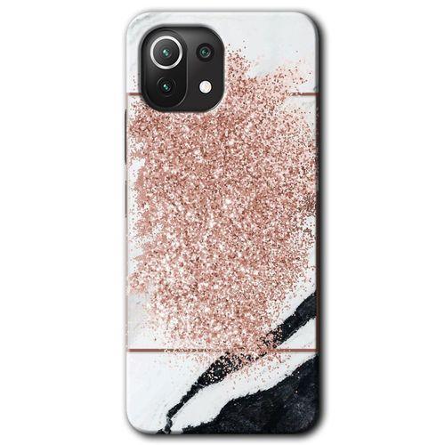 Xiaomi Mi 11 HD Baskılı Kılıf + 9D Tam Ekran Koruyucu - Simli Mermer