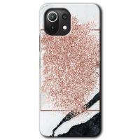 Xiaomi Mi 11 HD Baskılı Kılıf + 9D Tam Ekran Koruyucu - Simli Mermer