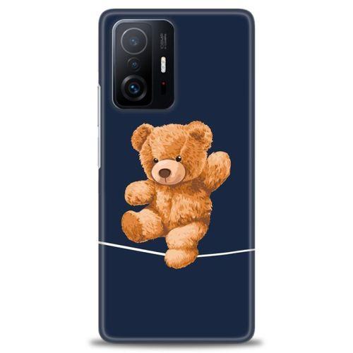 Xiaomi Mi 11T Pro Kılıf HD Baskılı Kılıf - İpteki Teddy + Tam Ekran Koruyucu
