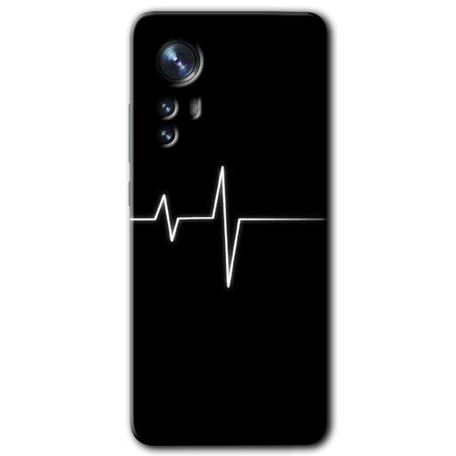 Xiaomi Mi 12 Kılıf HD Desen Baskılı Arka Kapak + Temperli Cam - Heart Rytm