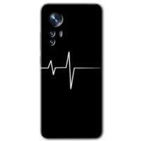 Xiaomi Mi 12 Kılıf HD Desen Baskılı Arka Kapak + Temperli Cam - Heart Rytm