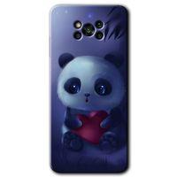 BeRa Aksesuar Poco x3 NFC Kılıf Baskılı Kapak - Bebek Panda +Tam Kaplayan Mat Seramik