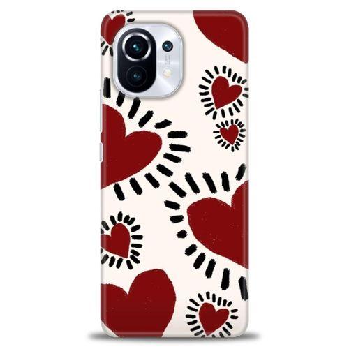 Xiaomi Mi 11 Kılıf HD Baskılı Kılıf - Çizgili Kalp + Tam Ekran Koruyucu