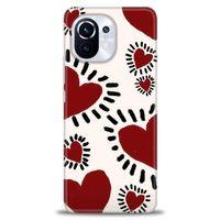 Xiaomi Mi 11 Kılıf HD Baskılı Kılıf - Çizgili Kalp + Tam Ekran Koruyucu