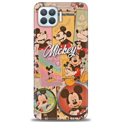 Oppo A73 Kılıf HD Baskılı Kılıf - I Love Mickey + Tam Ekran Koruyucu