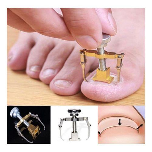 Batık Tırnak Çıkarma Aparatı