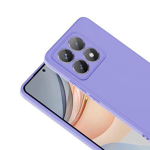 Xiaomi 14T Kılıf Zore Mara Lansman Kapak