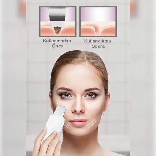 Ultrasonıc Siyah Nokta  Akne Spatula Şarjlı Cilt Temizleyici