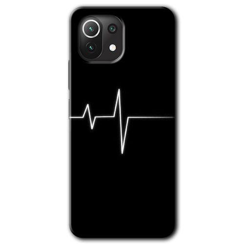 Potkal Hediye Fabrikası Xiaomi Mi 11 Kılıf HD Desen Baskılı Arka Kapak - Heart Rytm