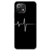 Potkal Hediye Fabrikası Xiaomi Mi 11 Kılıf HD Desen Baskılı Arka Kapak - Heart Rytm