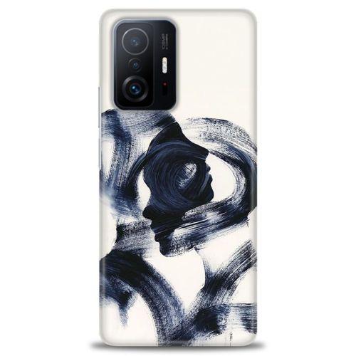 Xiaomi Mi 11T Kılıf HD Baskılı Kılıf - Adam ve Kadın + Tam Ekran Koruyucu