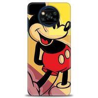 Xiaomi Poco X3 Pro Kılıf HD Baskılı Kılıf - Mickey Mousee + Tam Ekran Koruyucu
