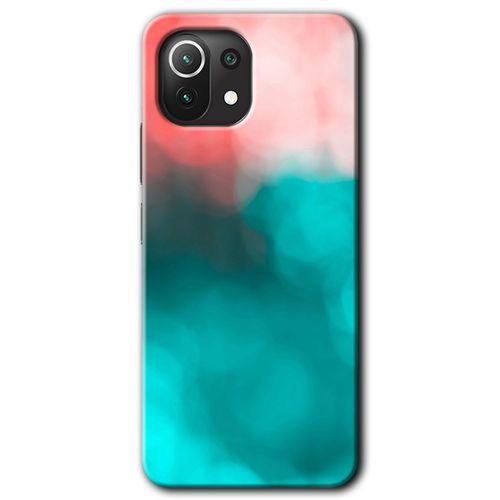Xiaomi Mi 11 Lite Kılıf Baskılı Arka Kapak - Flu Işık +Tam Ekran Koruyucu