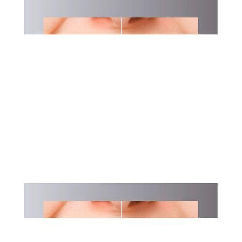 Led Işıklı Profesyonel Diş Beyazlatma Seti