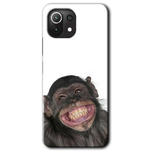 Xiaomi Mi 11 Lite Kılıf HD Desen Baskılı Arka Kapak - Şıpsevdi Aşk
