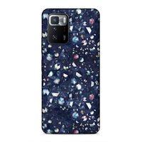 Xiaomi Poco X3 GT Uyumlu Kılıf Utopia (36) Glitter Kılıf Kahverengi