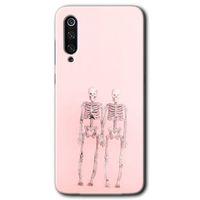 MRCİLETİSİM Xiaomi Mi 9 SE Kılıf Baskılı Kapak - Yaşayan Çift + 5D Tam Kaplayan Cam