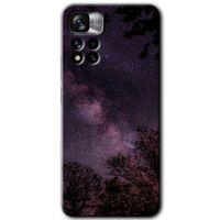 Potkal Hediye Fabrikası Xiaomi Redmi Note 11 Pro Plus 5G Kılıf HD Desen Baskılı Arka Kapak - Gece Galaksi