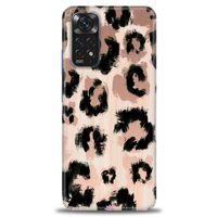 Xiaomi Redmi Note 11 Kılıf HD Baskılı Kılıf - Leopar + Tam Ekran Koruyucu