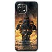 MRCİLETİSİM Xiaomi Mi 11 Lite Kılıf Kapak - Siyah İnci +Hayalet Ekran Yandan Gözükmez