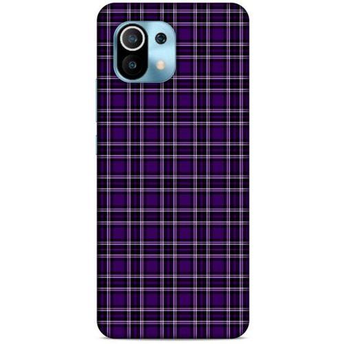 Xiaomi Redmi K30 Pro Uyumlu Kılıf Mor Delisi (11) Tam Koruma Çizgili