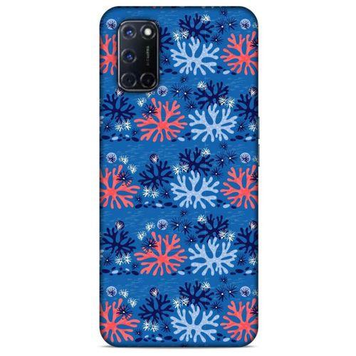 Oppo A72 Uyumlu Kılıf Mavi Delisi (36) Glitter Kılıf Lokal