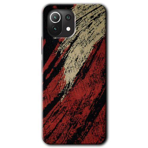 Xiaomi Mi 11 Lite Kılıf HD Desen Baskılı Arka Kapak + Temperli Cam - Kumaş Deseni 6