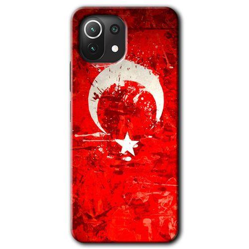 Xiaomi Mi 11 HD Baskılı Kılıf + 9D Tam Ekran Koruyucu - Albayrak 2