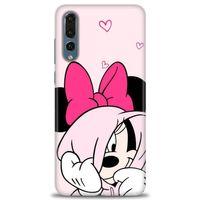 Huawei P20 Pro Kılıf HD Baskılı Kılıf - Pink + Tam Ekran Koruyucu