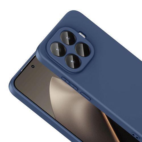 Xiaomi 15T Pro Kılıf Zore Mara Lansman Kapak