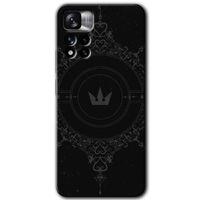 MRCİLETİSİM Xiaomi Redmi Note 11 Pro Plus 5G Kılıf HD Desen Baskılı Arka Kapak+Temperli Cam - Siyah Mandala 1