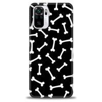 Xiaomi Redmi Note 10 Kılıf HD Baskılı Kılıf - Kemikler + Tam Ekran Koruyucu