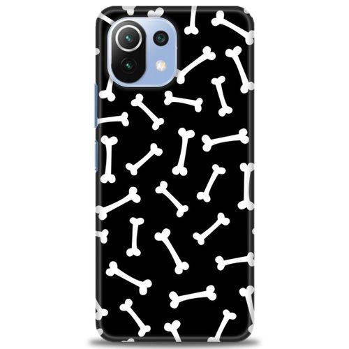 Xiaomi Mi 11 Lite Kılıf HD Baskılı Kılıf - Kemikler + Tam Ekran Koruyucu