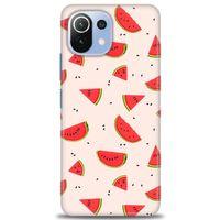 Xiaomi Mi 11 Lite Kılıf HD Baskılı Kılıf - Karpuz Dilimleri + Tam Ekran Koruyucu