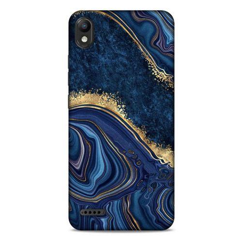 LG K20 2019 Uyumlu Kılıf Mavi Delisi (1) Kılıfı Mermer