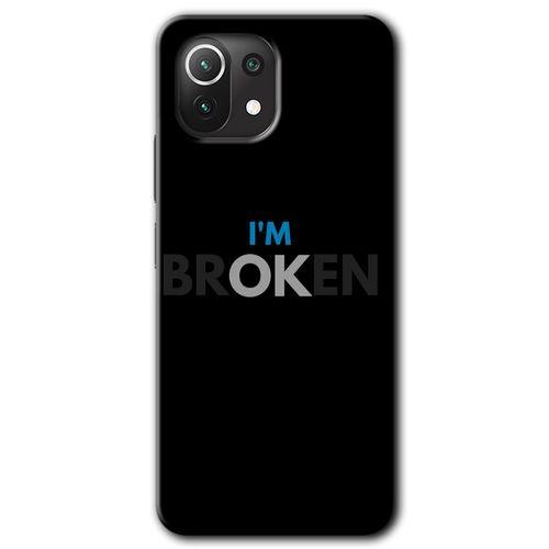 Xiaomi Mi 11 Lite Kılıf HD Desen Baskılı Arka Kapak + Temperli Cam - Im Broken