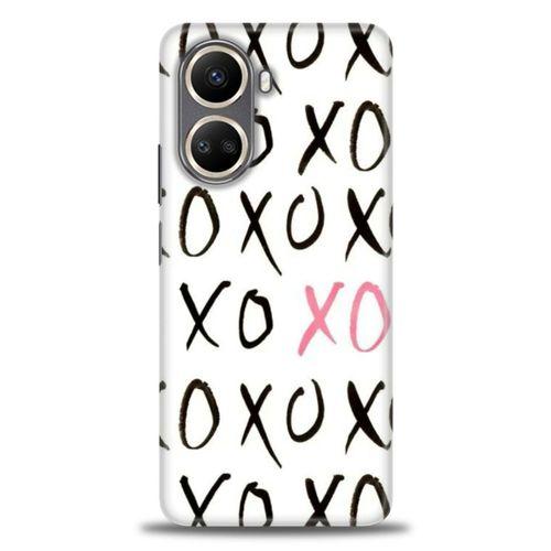 Realme C55 Kılıf HD Baskılı Kılıf - XOXO + Tam Ekran Koruyucu
