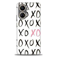 Realme C55 Kılıf HD Baskılı Kılıf - XOXO + Tam Ekran Koruyucu