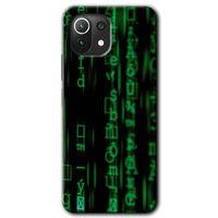 Xiaomi Mi 11 Lite Kılıf HD Desen Baskılı Arka Kapak + Temperli Cam - Matrix