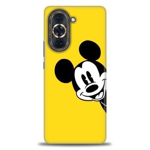 Huawei Nova 10 Kılıf HD Baskılı Kılıf - Sarı Mickey Mouse + Tam Ekran Koruyucu