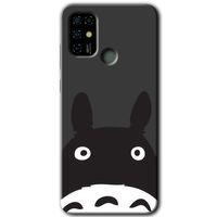 Casper Via F20 Kılıf HD Desen Baskılı Arka Kapak - Şaşkın Eşek