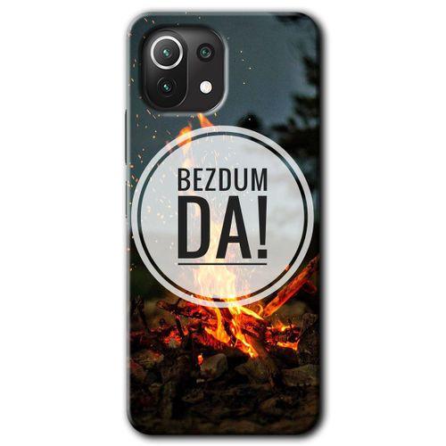 Xiaomi Mi 11 Lite Kılıf HD Desen Baskılı Arka Kapak + Temperli Cam - Bezdum Da