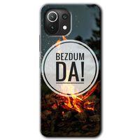 Xiaomi Mi 11 Lite Kılıf HD Desen Baskılı Arka Kapak + Temperli Cam - Bezdum Da