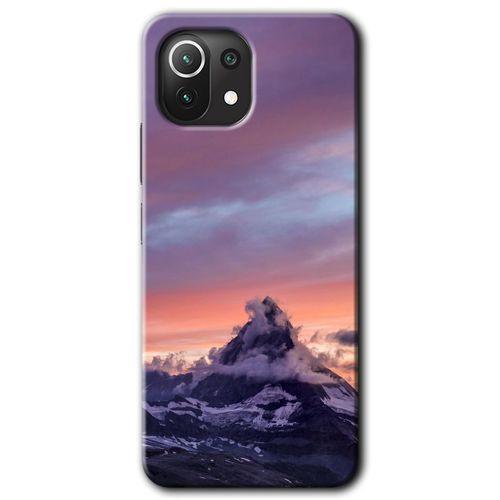 Potkal Hediye Fabrikası Xiaomi Mi 11 Kılıf HD Desen Baskılı Arka Kapak - Zirve