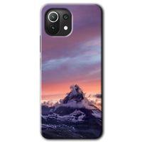 Potkal Hediye Fabrikası Xiaomi Mi 11 Kılıf HD Desen Baskılı Arka Kapak - Zirve