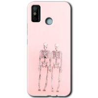 Tecno Spark 6 Go HD Baskılı Kılıf + 9D Tam Ekran Koruyucu - Yaşayan Çift