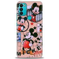 General Mobile GM 21 Plus Kılıf HD Baskılı Kılıf - Mickey Mouse + Tam Ekran Koruyucu