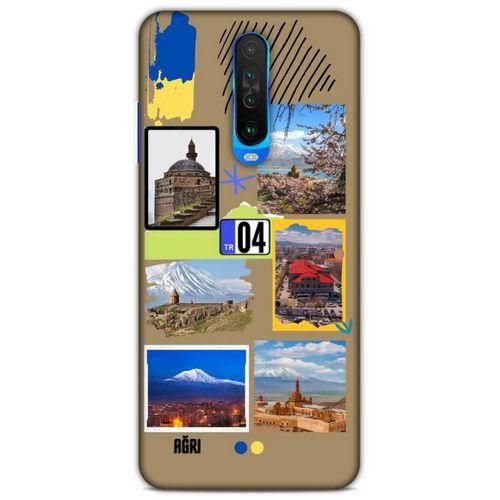 Lopard Xiaomi Redmi K30 5G Uyumlu Kılıf Şehirli ※ (4) Ağrı Koruma Kılıfı