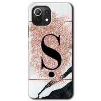 Potkal Hediye Fabrikası Xiaomi Mi 11 Kılıf HD Desen Baskılı Arka Kapak - Pembe Mermer Desenli Ş Harfi