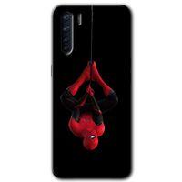 Oppo A91 Kılıf HD Desen Baskılı Arka Kapak - Örümcek Adam